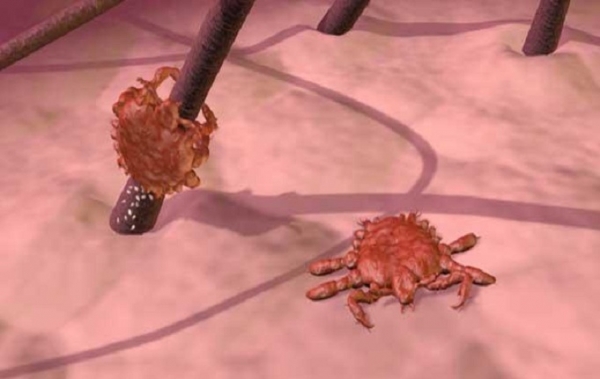 Если по утрам чешется лобок, скорее всего, у вас лобковые вши