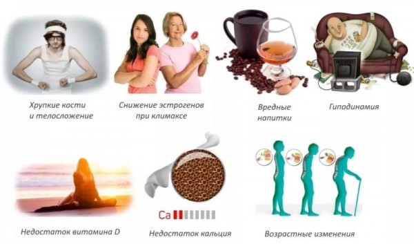 Что такое остеопороз, симптомы и причины болезни костей