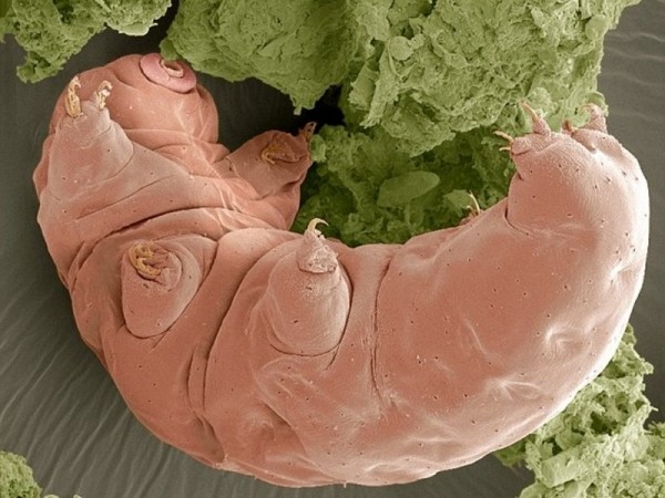 ГМО-клетки человека с ДНК тихоходки помогут космонавтам ГМО-клетки человека с ДНК тихоходки помогут космонавтам