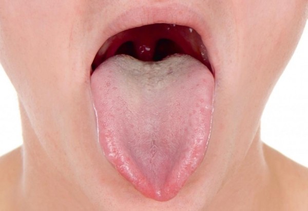 О чем сигнализирует раздутый язык О чем сигнализирует раздутый язык