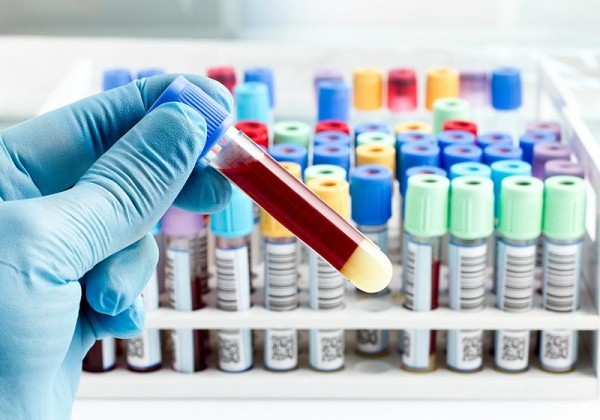 Системная красная волчанка — описание, симптомы и методы лечения Системная красная волчанка — описание, симптомы и методы лечения